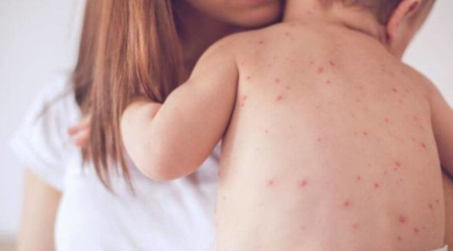 ΙΛΑΡΑ ΣΤΗΝ ΕΥΡΩΠΗ: ΓΙΑΤΙ Ο ΕΜΒΟΛΙΑΣΜΟΣ ΠΑΡΑΜΕΝΕΙ ΚΡΙΣΙΜΟΣ